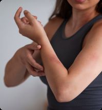 Vrouw heeft jeuk aan haar arm